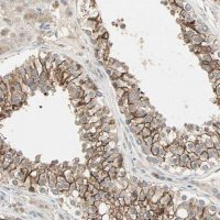 Anti-TTF2 antibody produced in rabbit HPA005776-100UL