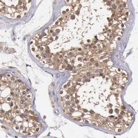 Anti-TTLL12 antibody produced in rabbit 