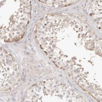 Anti-TTLL4 antibody produced in rabbit 