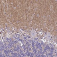 Anti-TTYH1 antibody produced in rabbit HPA050655-100UL