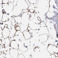 Anti-TUSC5 antibody produced in rabbit 