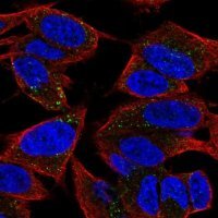 Anti-TVP23A antibody produced in rabbit 