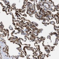 Anti-TVP23B antibody produced in rabbit 