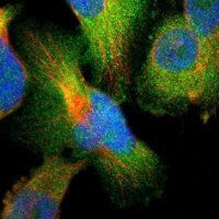 Anti-TWF1 antibody produced in rabbit
