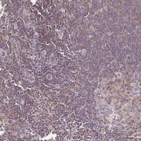 Anti-TWF2 antibody produced in rabbit HPA053874-100UL