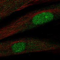 Anti-TWIST2 antibody produced in rabbit 