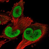 Anti-TXNRD1 antibody produced in rabbit