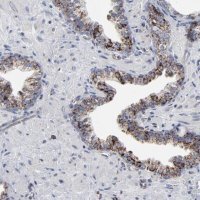 Anti-TXNRD2 antibody produced in rabbit HPA003323-100UL