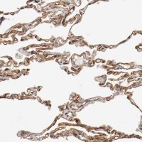 Anti-TYK2 antibody produced in rabbit
