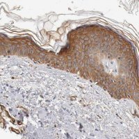 Anti-TYK2 antibody produced in rabbit