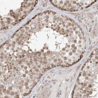 Anti-TYSND1 antibody produced in rabbit