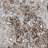 Anti-TYW1 antibody produced in rabbit HPA015535-100UL