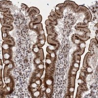 Anti-U2SURP antibody produced in rabbit HPA037545-100UL