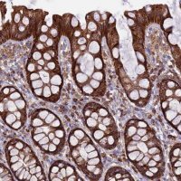 Anti-UAP1L1 antibody produced in rabbit 