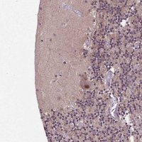 Anti-UBA3 antibody produced in rabbit HPA034874-100UL