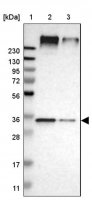 Anti-UBAC2 antibody produced in rabbit 