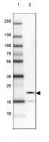 Anti-UBALD2 antibody produced in rabbit