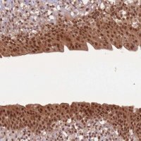Anti-UBB antibody produced in rabbit 