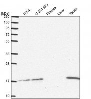 Anti-UBE2A antibody produced in rabbit 