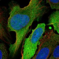Anti-UBE2C antibody produced in rabbit 