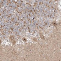 Anti-UBE2F antibody produced in rabbit HPA037444-100UL