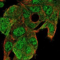 Anti-UBE2G1 antibody produced in rabbit HPA050551-100UL