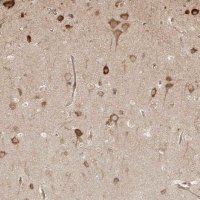 Anti-UBE2K antibody produced in rabbit 