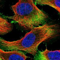Anti-UBE2S antibody produced in rabbit