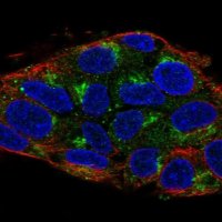 Anti-UBIAD1 antibody produced in rabbit 