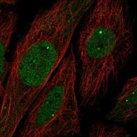 Anti-UBN1 antibody produced in rabbit 