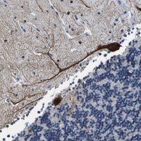 Anti-UBN2 antibody produced in rabbit 