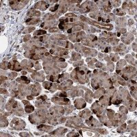 Anti-UBR1 antibody produced in rabbit 