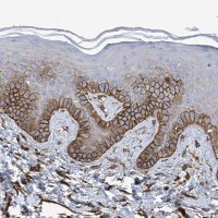 Anti-UBTD1 antibody produced in rabbit 