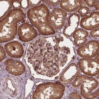 Anti-UBXN2A antibody produced in rabbit 