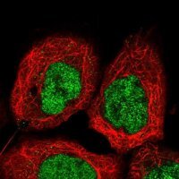 Anti-UBXN2B antibody produced in rabbit 