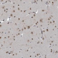 Anti-UCK1 antibody produced in rabbit 