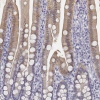 Anti-UCN2 antibody produced in rabbit
