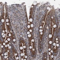 Anti-UCN3 antibody produced in rabbit 