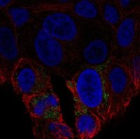 Anti-UCP2 antibody produced in rabbit 