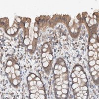 Anti-UGCG antibody produced in rabbit 