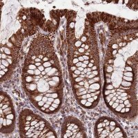 Anti-ULK3 antibody produced in rabbit 