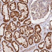Anti-UMPS antibody produced in rabbit