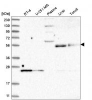 Anti-UNC93A antibody produced in rabbit 