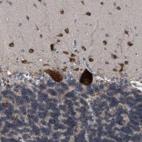 Anti-UPF1 antibody produced in rabbit 
