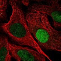 Anti-UPP1 antibody produced in rabbit