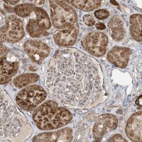 Anti-UQCC1 antibody produced in rabbit 
