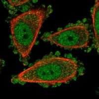 Anti-UROD antibody produced in rabbit 