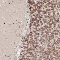 Anti-USF3 antibody produced in rabbit 