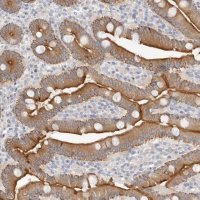 Anti-USH1C antibody produced in rabbit 
