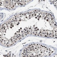 Anti-USP16 antibody produced in rabbit 